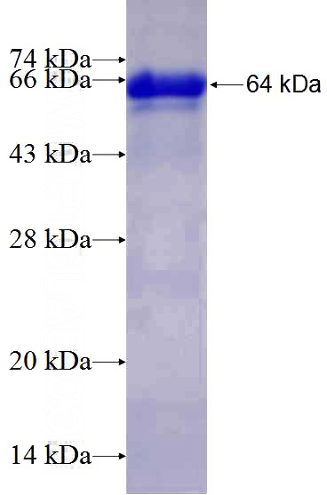 Recombinant Human SND1 SDS-PAGE