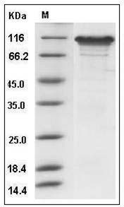 Human Neuroligin-3 / NLGN3 Protein (His Tag) SDS-PAGE