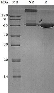 Human P4HB/ERBA2L/PDI/PDIA1/PO4DB (His tag) recombinant protein