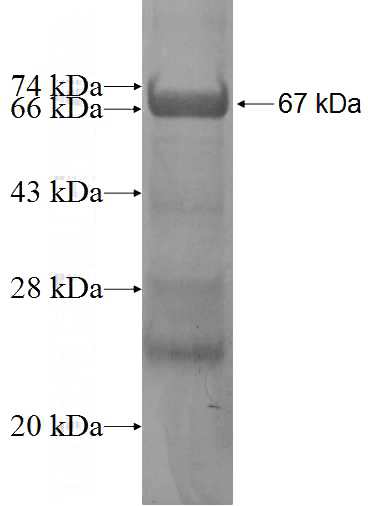 Recombinant Human RLBP1L1 SDS-PAGE