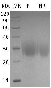 Human CSF2/GMCSF recombinant protein