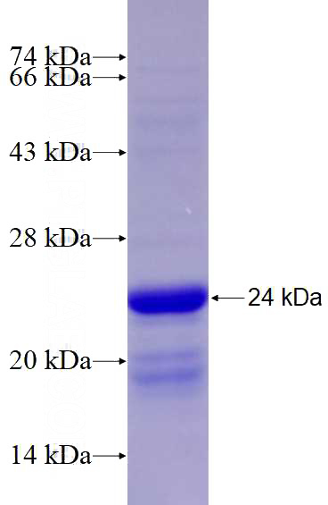 Recombinant Human Ninein SDS-PAGE