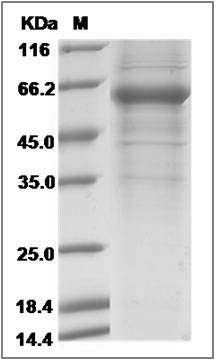 Human B3GALT5 Protein (Fc Tag) SDS-PAGE
