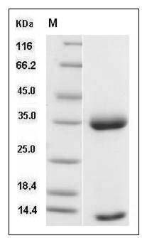 Cynomolgus FCGRT & B2M Heterodimer Protein SDS-PAGE