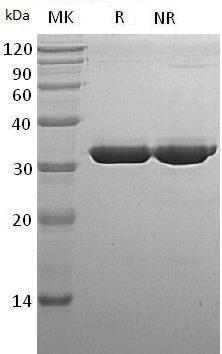 Human SULT1A1/STP/STP1/OK/SW-cl.88 (His tag) recombinant protein