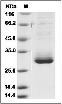 Human RAB27B Protein (His Tag) SDS-PAGE