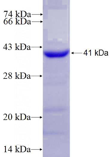 Recombinant Human CD11a/Integrin alpha-L SDS-PAGE
