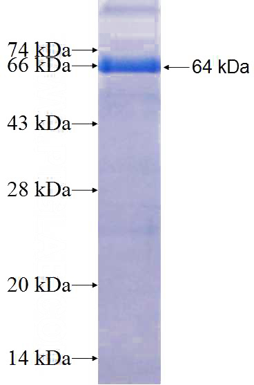 Recombinant Human HELB SDS-PAGE