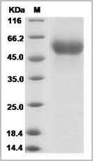 Influenza A H5N1 (A/Thailand/1(KAN-1)/2004) Hemagglutinin Protein (His Tag)