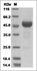 Human TMED4 / ERS25 Protein (Fc Tag) SDS-PAGE