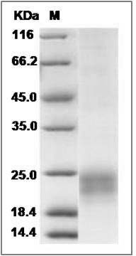 Cynomolgus NKG2D / KLRK1 Protein (aa 78-216, His Tag) SDS-PAGE