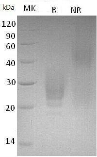 Human BOC/hCG_17534 (His tag) recombinant protein