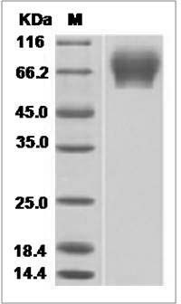 Influenza A H5N8 (A/turkey/Germany-MV/R2472/2014) Hemagglutinin / HA1 Protein (His Tag)