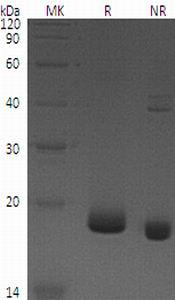 Human IFNL3/IL28B/IL28C/ZCYTO22 recombinant protein