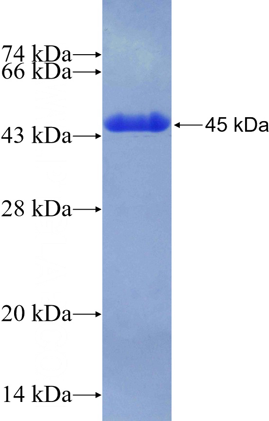 Recombinant Human C9orf125 SDS-PAGE
