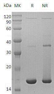 Human UBE2D3/UBC5C/UBCH5C recombinant protein