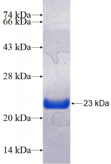 Recombinant Human PPP1R14D SDS-PAGE