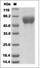 Influenza A H9N2 (A/Hong Kong/35820/2009) Hemagglutinin / HA1 Protein (His Tag)