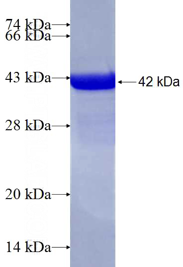 Human MMP19 Recombinant protein (6*His tag)