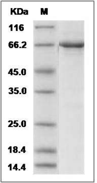 Human EphB4 / HTK Protein (aa 563-987, His & GST Tag) SDS-PAGE
