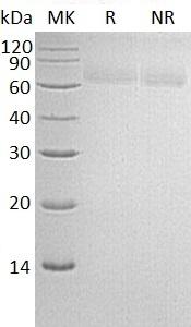 Human TGOLN2/TGN46/TGN51 (His tag) recombinant protein