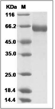 Influenza A H5N1 (A/chicken/VietNam/NCVD-016/2008) Hemagglutinin / HA Protein (His Tag) SDS-PAGE