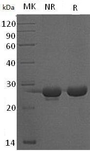 Mouse Fgf9/Fgf-9 (His tag) recombinant protein