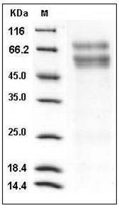 Mouse CHST3 / C6ST-1 Protein (His Tag) SDS-PAGE