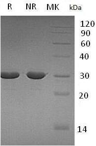 Human ABCB5 (Trx tag) recombinant protein
