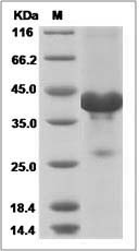Human IGFL2 Protein (Fc Tag) SDS-PAGE