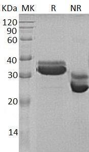 Human IGFBP4/IBP4 (His tag) recombinant protein