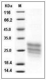 Human Cripto / TDGF1 Protein (His Tag) SDS-PAGE