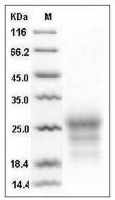 Mouse CD90 / THY-1 Protein (His Tag) SDS-PAGE