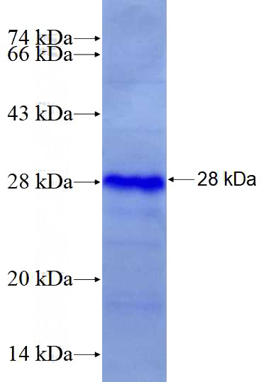 Recombinant Human EDN1 SDS-PAGE
