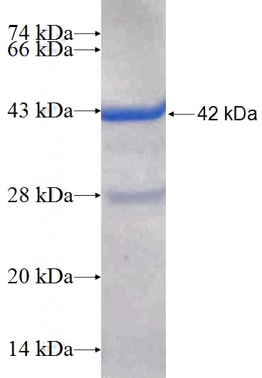 Recombinant Human CCDC8 SDS-PAGE
