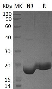 Human IFNL3/IL28B/IL28C/ZCYTO22 (His tag) recombinant protein