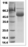 Human FSH Beta / FSHB Protein 15085