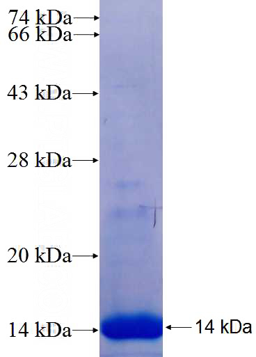 Recombinant Human LMO1 SDS-PAGE