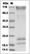 Ebola virus EBOV (subtype Sudan, strain Gulu) GP / Glycoprotein Protein (His Tag)