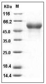 Mouse Fetuin-A / AHSG Protein (His Tag) SDS-PAGE