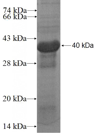 Recombinant Human C10orf119 SDS-PAGE