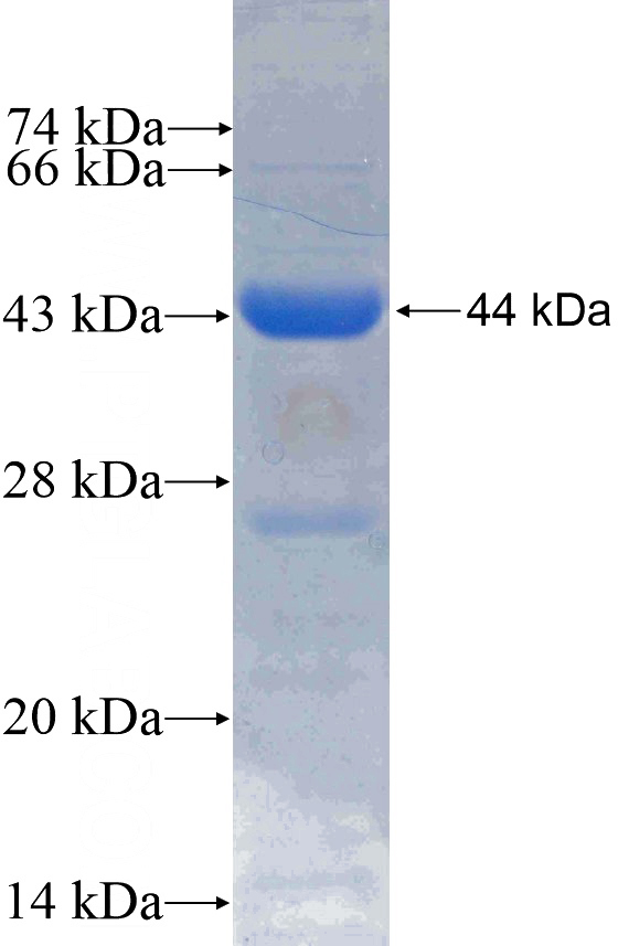 Recombinant Human THRB SDS-PAGE