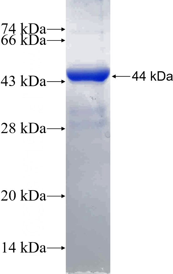 Recombinant Human COMT SDS-PAGE