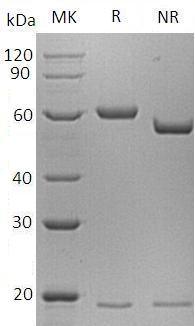 Mouse Pcsk9/Narc1 (His tag) recombinant protein