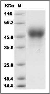 Rat Coagulation Factor III / Tissue Factor / CD142 Protein (His Tag) SDS-PAGE