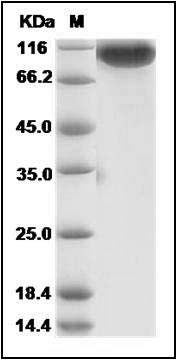 Novel coronavirus (HCoV-EMC/2012) Spike Protein S1 (aa 1-725, His Tag) SDS-PAGE