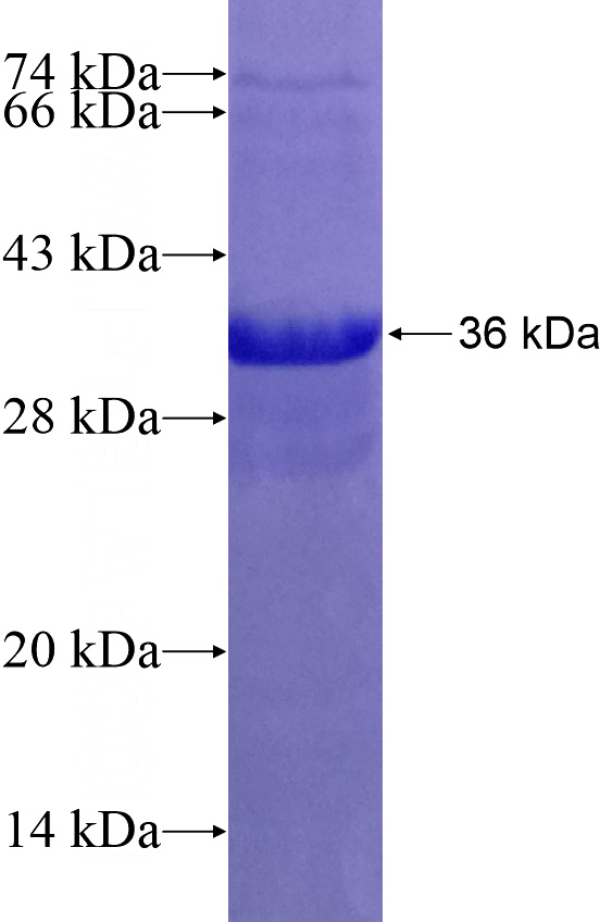 Recombinant Human SLC30A7 SDS-PAGE