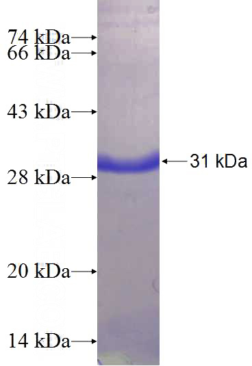 Recombinant Human C15orf38 SDS-PAGE
