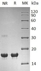 Human SUMO2/SMT3B/SMT3H2 (His tag) recombinant protein