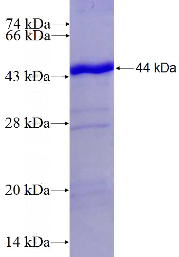 Recombinant Human AMH SDS-PAGE